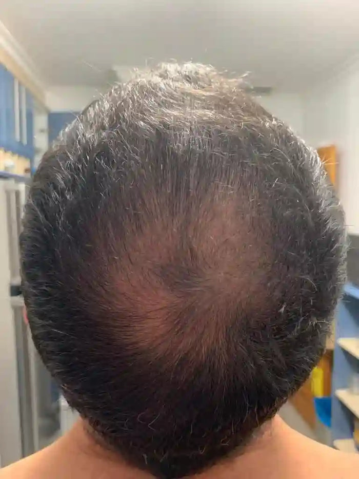 Prolonga el ciclo natural del cabello