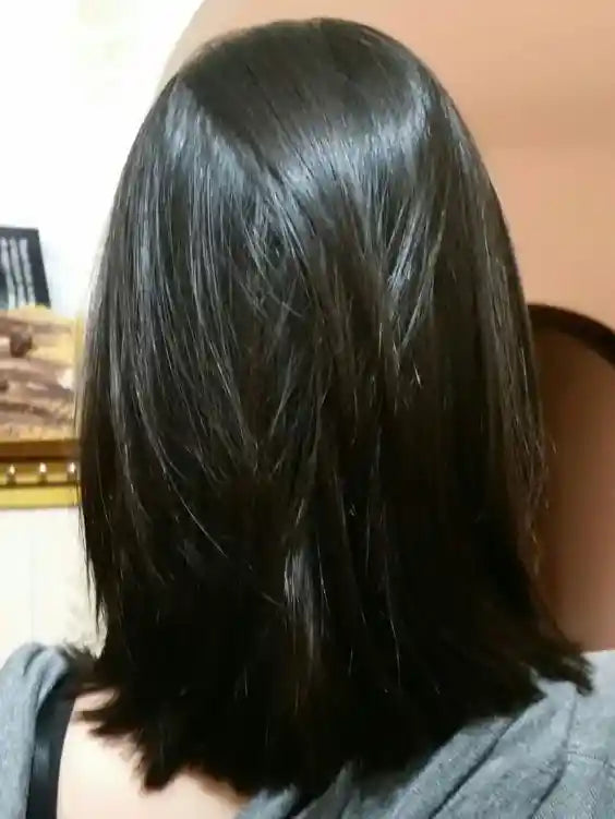 Aumenta la densidad capilar